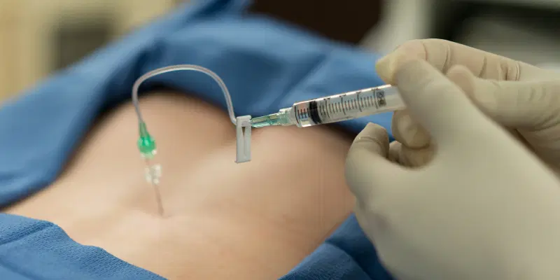 Transforaminal Epidural Injection